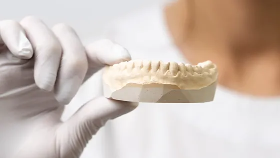 Profissionais experientes para fazer a remoção